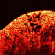Image for article titled How We Can Use Light to See Inside the Human Body